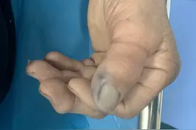 吓人！花盆里居然藏着竹叶青，广西一男子被咬伤！竹叶青有多毒？图片