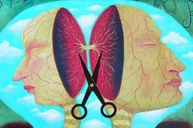一次大脑手术，让他有了裂脑人的称呼，他的身体也产生了两个灵魂图片