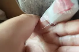 月嫂给宝宝剪指甲划伤手指 宝妈要求退还中介费遭拒绝图片