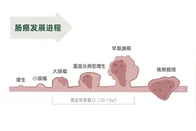 结直肠癌“发现即晚期”， 5年生存率仅14%！这样做能降低晚期风险图片