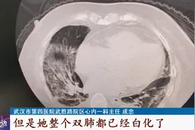 什么情况下会出现白肺？白肺能预防吗？提醒：这些人做个CT很有必要图片