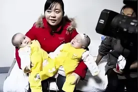 09年湖北产妇生下连体女婴，医生看了直摇头，如今她们怎么样了？图片