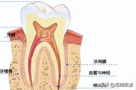 牙没了想补牙，选烤瓷牙还是种植牙？图片