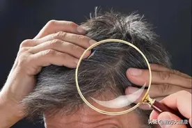 你有白头发吗？不同部位白发对应不同脏腑！这套方案，白发变黑！图片