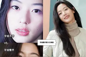 “牙齿”对颜值的影响究竟有多大？看完这几组对比图，你就知道了图片