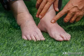 身体好不好，看脚就知道？脚部出现肿胀、疼痛，别不当回事图片