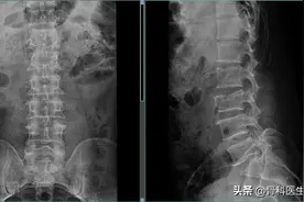 医学影像图片共分享（十六）图片
