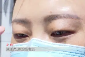 呼和浩特一对闺蜜看中广告去纹眉 结果差别有点大！机构拒绝采访 这样回应......图片