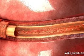 老年高血压患者“高压高、低压低”，降压药的吃法有何讲究？图片