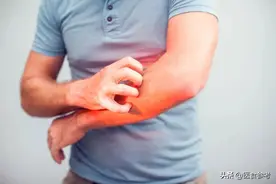 身上这3处痒，可能是癌症来了图片