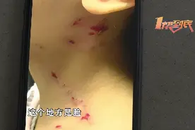 7岁女孩玩耍时被陌生宝妈抓得满脸血印，爷爷：“我活了70年，从来没见过这么狠心的人”图片