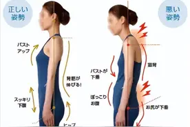 干货教程 /“背太厚”单单是因为脂肪太多？图片