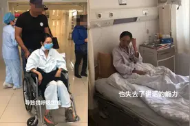 56岁张咪自曝抗癌经历！脸部口腔癌化不能讲话，喝水要敷麻药进食图片