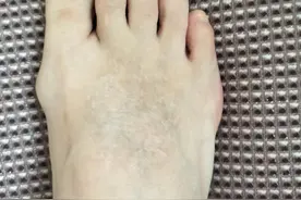 花几千元没有治好的怪病，被一名普通医生仅用一百多元钱治好了。图片