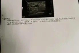 解读乳腺超声检查报告：乳腺3类结节图片