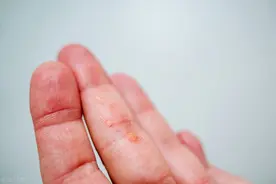 你真的了解HPV吗？一字张图告诉你，仔细对照12种类型图片