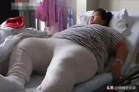 2014年,安徽21岁"巨无霸孕妇"294斤,遭4家医院拒收,医生:风险太大图片