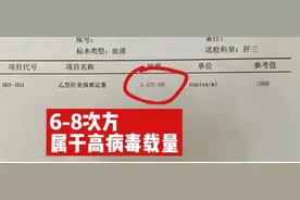 乙肝病毒量高低看这个数值就够了图片