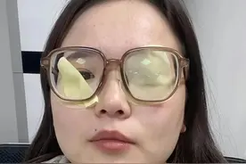 高度近视度数真的能降！！图片