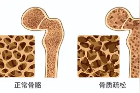 中老年高发、年轻人也易中招！面对“隐形杀手”，江苏教授揭示治疗新靶点！图片