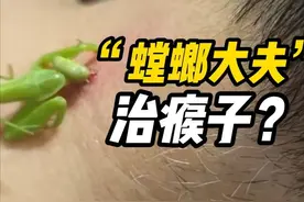 螳螂“大夫”为男子治瘊子：咬了20分钟，“螳医生”真的科学吗？图片