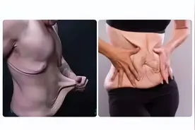 减脂后皮肤松弛怎么办？健身必看图片