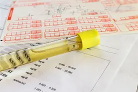 尿蛋白和尿微量白蛋白不是一回事！图片