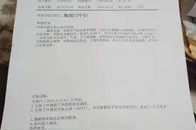 肺部CT影像报告出现这几个字，需要警惕肺癌！图片