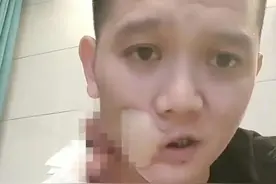 36岁歌手傅松口腔癌去世！生前嚼槟榔6年，最后一次露面脸部溃烂图片