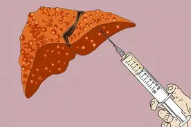 一针三十万，干掉肝癌细胞，“医疗核武器”普通人能够用得上吗？图片