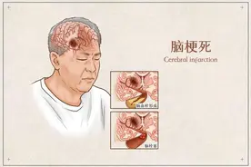 治疗脑梗的中药处方有哪些？图片