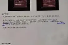 42岁女人体检的感受图片