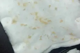 用手指刮过鼻子附近的皮肤，总能刮出一些泥状的脏东西，咋回事？图片