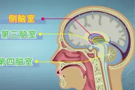 脑外伤后，辨别脑积水，你一定要懂图片