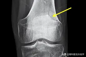 医学影像图片共分享（八）图片