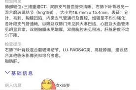 15mm极高危混磨结节病理翻盘该怎么办？精准诊断定方案需辅助治疗图片