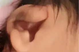 耳朵卷曲，原来她叫“杯状耳”图片