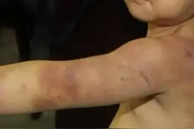 “妈妈，求你别打了”8岁男童“考得不好”遭暴打，却永远消失了图片