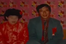 山东50岁老汉突然二次发育,2年疯长30公分,头部顶两个正常人大小图片