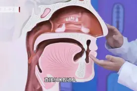 睡觉经常流口水，恐是7大疾病信号！不重视小病变大病图片