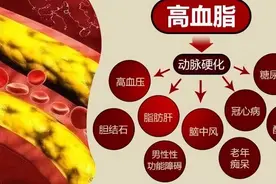 蹲一会儿突然站起来，“眼冒金星”，并非是低血糖？早了解早受益图片