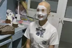 女学生频繁掉发索性剃成光头 医生：不能改善发质图片