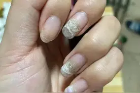 长期美甲的危害，真的不要频繁做指甲！！！图片