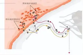 “蛇缠腰”如果长在腰间缠绕一圈就会夺人性命，真的是这样吗？图片