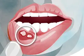 口腔疾病食疗妙方图片