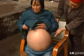 53岁村妇肚子胀得像气球，没钱治病拿刀剖腹“自救”，险些丧命图片
