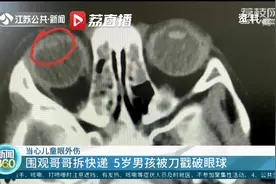 当心儿童眼外伤！围观哥哥拆快递 5岁男孩被刀戳破眼球图片