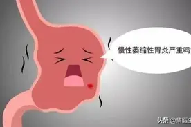 慢性萎缩性胃炎是怎么回事？会不会发生癌变？该注意些什么？图片