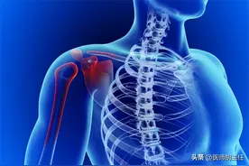 体内有癌，肩膀先知？提醒：肩膀出现2种异样，可能是肿瘤信号图片