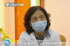 飞絮扬春季皮肤过敏高发 医生：注意规律作息图片